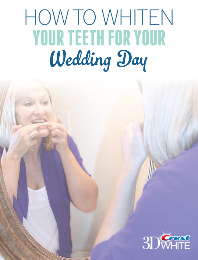 How To Whiten Your Teeth For Your Wedding Day | Brought To You By Crest 3D White via TheELD.com